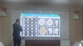 Proses operasi otak ditampilkan di layar yang dilakukan oleh pihak Rumah Sakit (RS) dr. Hasri Ainun Habibie Parepare, Sulawesi selatan