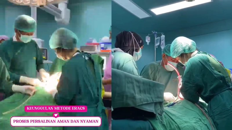 Suasana dokter melakukan persalinan dengan metode Enhanced Recovery After Caesarean Surgery (ERACS) di Rumah Sakit (RS) dr. Hasri Ainun Habibie Parepare