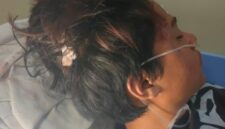 kondisi korban saat mendapatkan pelayanan medis